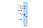 PSMC3IP Antibody in Western Blot (WB)