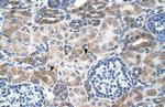 SLC14A1 Antibody in Immunohistochemistry (IHC)