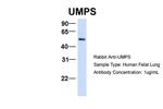 UMPS Antibody in Western Blot (WB)