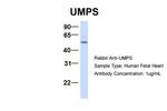 UMPS Antibody in Western Blot (WB)