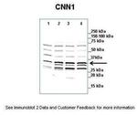 Calponin 1 Antibody in Western Blot (WB)