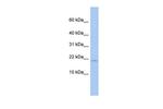 SH3BGRL Antibody in Western Blot (WB)