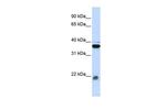 MYL9 Antibody in Western Blot (WB)