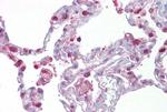 HPGDS Antibody in Immunohistochemistry (IHC)