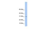 ECHDC1 Antibody in Western Blot (WB)