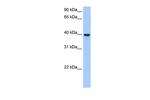 ST6GALNAC4 Antibody in Western Blot (WB)