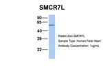 SMCR7L Antibody in Western Blot (WB)