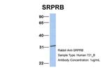 SRPRB Antibody in Western Blot (WB)