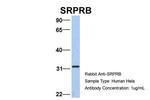 SRPRB Antibody in Western Blot (WB)