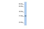 SRPRB Antibody in Western Blot (WB)