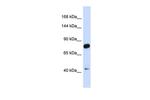 CDH23 Antibody in Western Blot (WB)