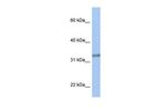 ACBD4 Antibody in Western Blot (WB)