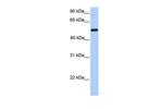 GALNT13 Antibody in Western Blot (WB)