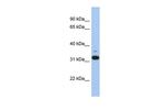 CMG2 Antibody in Western Blot (WB)