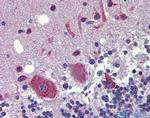 FEZF1 Antibody in Immunohistochemistry (IHC)