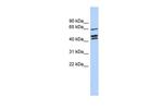 ZNF578 Antibody in Western Blot (WB)