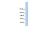 ZNHIT3 Antibody in Western Blot (WB)