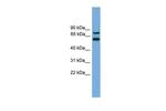 YY1AP1 Antibody in Western Blot (WB)