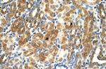 MAS1 Antibody in Immunohistochemistry (IHC)