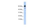 ABAT Antibody in Western Blot (WB)