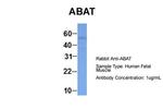 ABAT Antibody in Western Blot (WB)