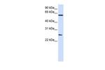 TCP-1 eta Antibody in Western Blot (WB)