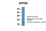 ATP5H Antibody in Western Blot (WB)