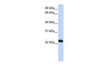 LAMTOR5 Antibody in Western Blot (WB)