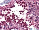 hCV-2 Antibody in Immunohistochemistry (IHC)