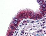 hCV-2 Antibody in Immunohistochemistry (IHC)