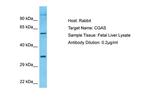 cGAS Antibody in Western Blot (WB)