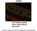 RAB3IP Antibody in Immunohistochemistry (IHC)