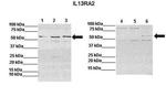 IL13RA2 Antibody in Western Blot (WB)
