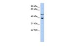 SOCS7 Antibody in Western Blot (WB)