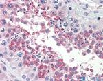 TSKS Antibody in Immunohistochemistry (IHC)