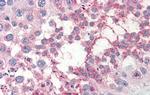 TSKS Antibody in Immunohistochemistry (IHC)