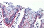 IMPDH1 Antibody in Immunohistochemistry (IHC)