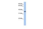 GALE Antibody in Western Blot (WB)