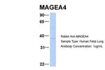 MAGEA4 Antibody in Western Blot (WB)