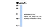 MAGEA4 Antibody in Western Blot (WB)