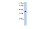 MAGEA4 Antibody in Western Blot (WB)