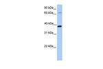 HMBS Antibody in Western Blot (WB)