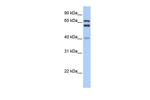 GCLC Antibody in Western Blot (WB)