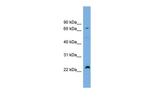 SPG20 Antibody in Western Blot (WB)