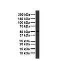 TBC1D1 Antibody in Western Blot (WB)