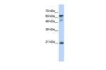 GCSAM Antibody in Western Blot (WB)