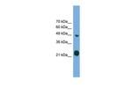 RAB37 Antibody in Western Blot (WB)