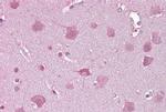 NDP Antibody in Immunohistochemistry (IHC)