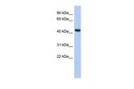 EXOC4 Antibody in Western Blot (WB)