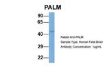 PALM Antibody in Western Blot (WB)